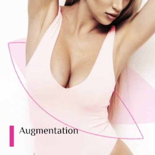 What Is Breast Augmentation And Breast Lifting Surgery